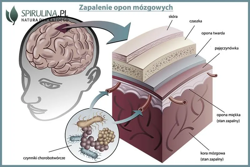 Objawy u niemowląt